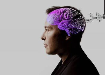 Người cấy chip não của Elon Musk đang hồi phục