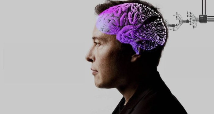 Người cấy chip não của Elon Musk đang hồi phục