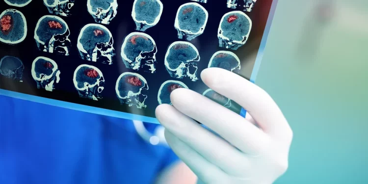 Sử dụng AI tái lập trình tế bào ung thư