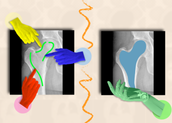 ScribblePrompt-ho-tro-doc-hieu-hinh-anh-y-te