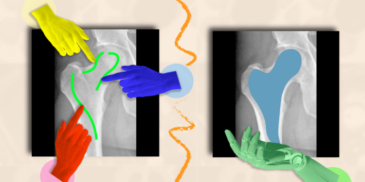 ScribblePrompt-ho-tro-doc-hieu-hinh-anh-y-te